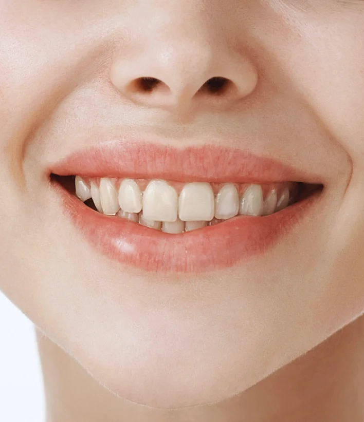 عن داماس 5 before